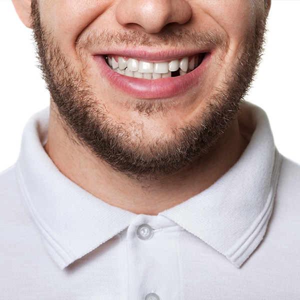 missing tooth