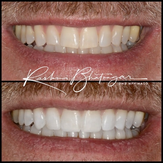 before after 083022 1