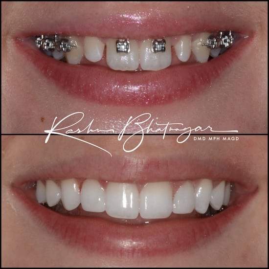 before after 083022 2