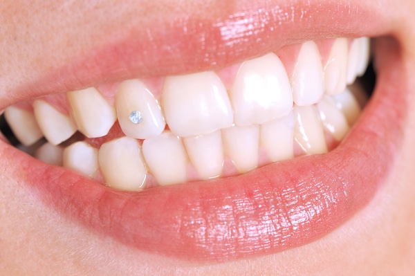 tooth gems pic
