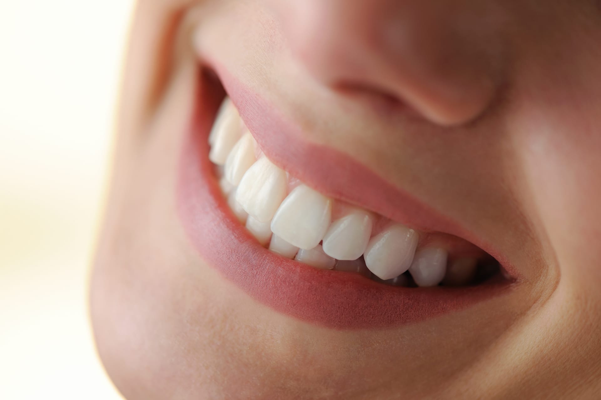 veneers header