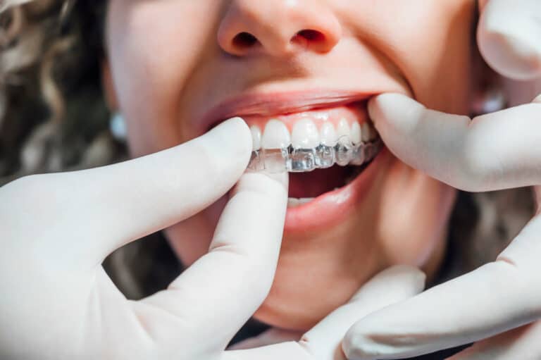 Doctor putting a clear dental aligner to the patient woman Bella Vista Dental Care