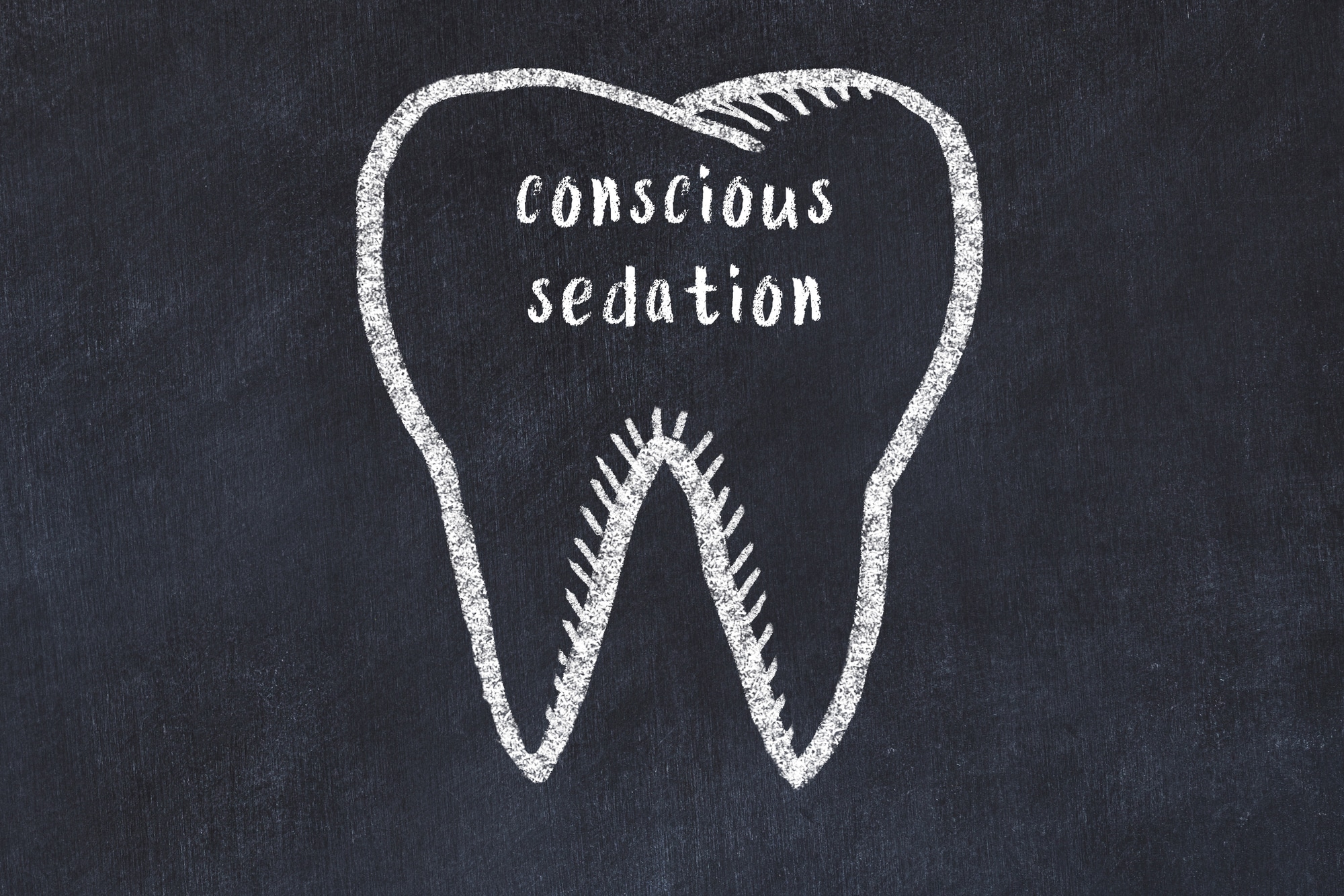 Benefits of Conscious Sedation for Dental Procedures