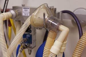 5 Things to Know Before Getting Nitrous Oxide