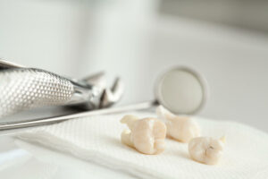 managing pain after tooth extraction
