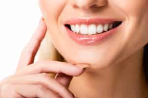 composite vs traditional veneers