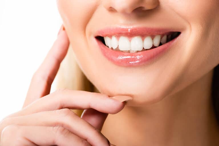 composite vs traditional veneers