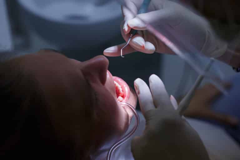 root canal
