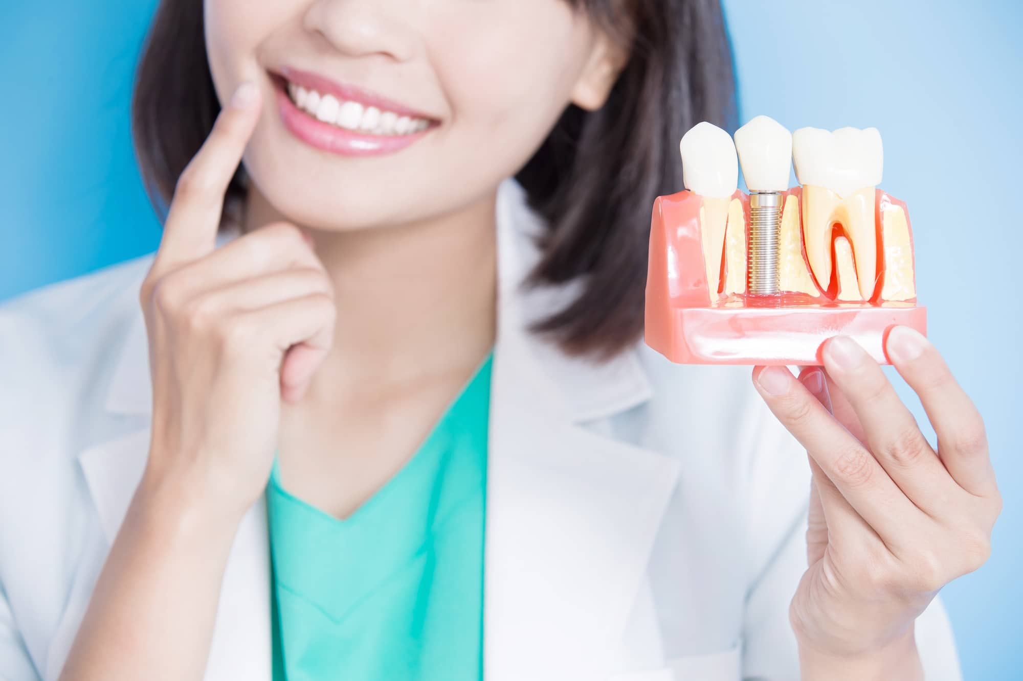 smile brought by dental implant