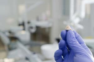 Wisdom Teeth-Dentique