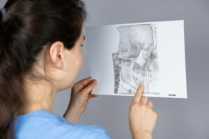 A doctor holds a CT scan of a patient with TMD