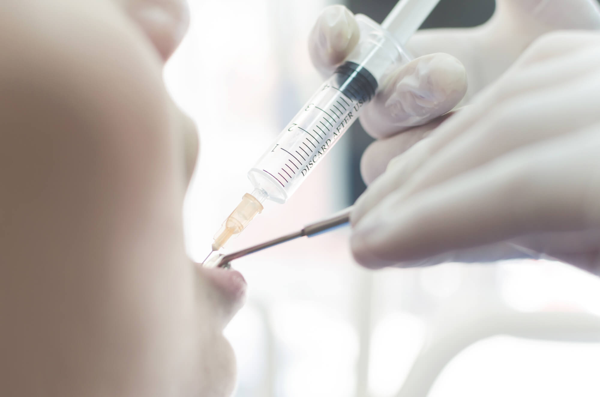 anesthesia for patients
