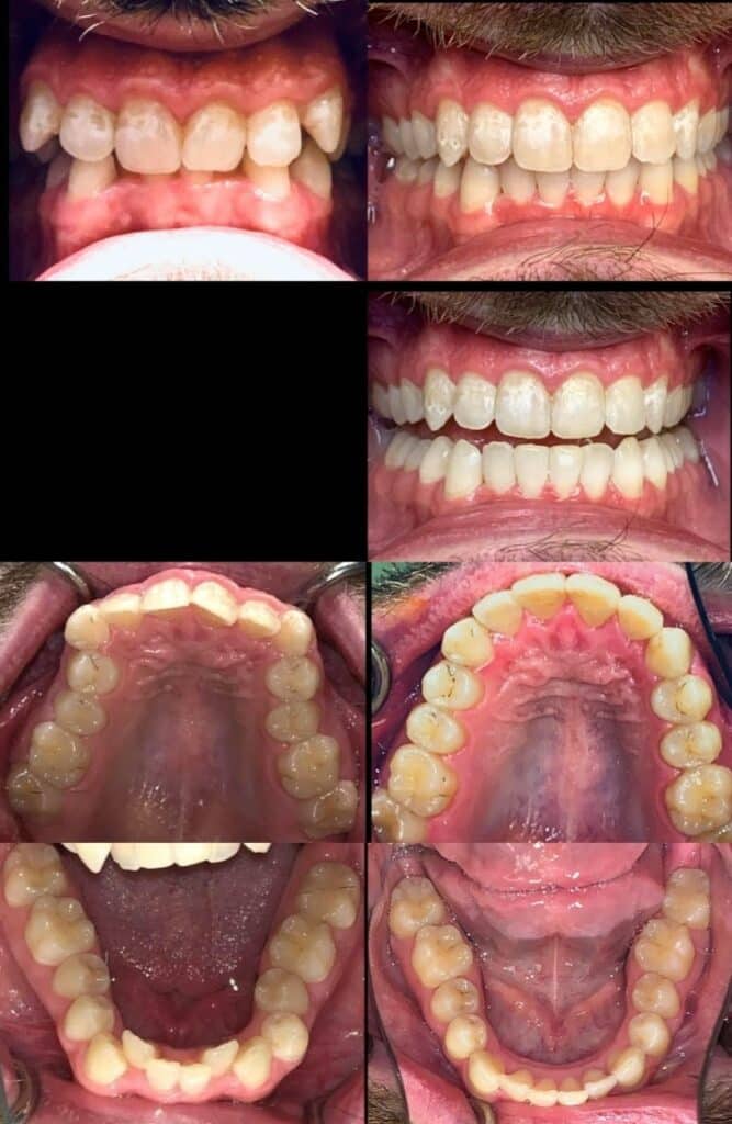case 4 814x1251