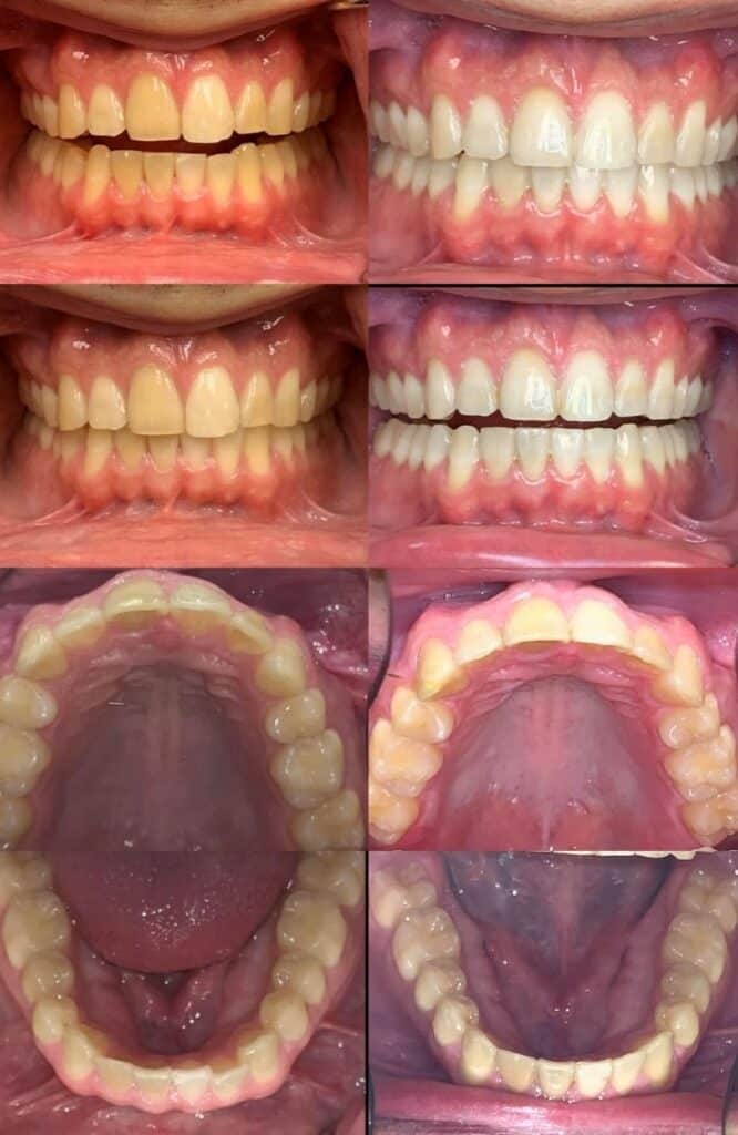 case 5 814x1251