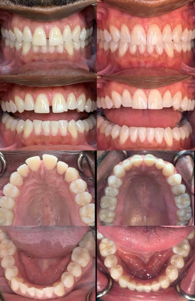case 6 814x1251