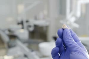 hand holding an extracted tooth
