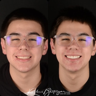 before and after