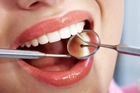 dental exam up close